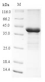 Recombinant Human Tescalcin (TESC) – Figure 1 of 1