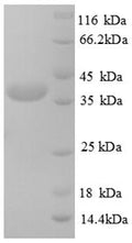 Recombinant Human Testis-expressed sequence 12 protein (TEX12) – Figure 1 of 1