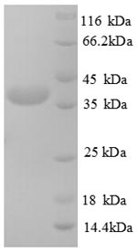 Recombinant Human Testis-expressed sequence 12 protein (TEX12) – Figure 1 of 1