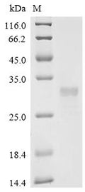 (Tris-Glycine gel) Discontinuous SDS-PAGE (reduced) with 5% enrichment gel and 15% separation gel.