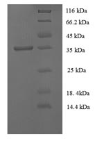 Recombinant Rabbit Tissue factor pathway inhibitor (TFPI) – Figure 1 of 1