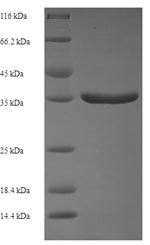 Recombinant Sheep Protransforming growth factor alpha (TGFA), partial – Figure 1 of 1