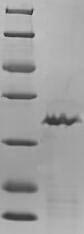 Recombinant Chicken Transforming growth factor beta-1 proprotein (TGFB1), partial – Figure 1 of 1