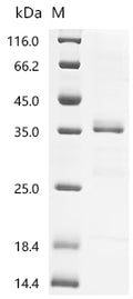 (Tris-Glycine gel) Discontinuous SDS-PAGE (reduced) with 5% enrichment gel and 15% separation gel.