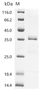 (Tris-Glycine gel) Discontinuous SDS-PAGE (reduced) with 5% enrichment gel and 15% separation gel.