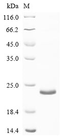 Recombinant Mouse Transforming growth factor beta-1 proprotein (Tgfb1), partial – Figure 1 of 1