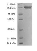 Recombinant Human Protein-glutamine gamma-glutamyltransferase 2 (TGM2), partial – Figure 1 of 1