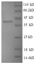 Recombinant Mouse Thrombospondin-1 (Thbs1), partial – Figure 1 of 1