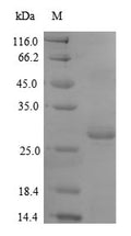 Recombinant Mouse Thrombospondin-2 (Thbs2), partial – Figure 1 of 1
