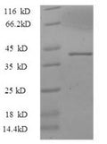 Recombinant Mouse Thrombospondin-3 (Thbs3), partial – Figure 1 of 1