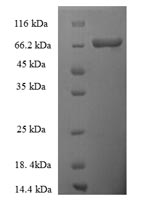 Recombinant Human Thyroid hormone receptor beta (THRB) – Figure 1 of 1