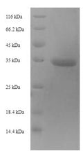 Recombinant Mouse Metalloproteinase inhibitor 1 (Timp1) – Figure 1 of 1