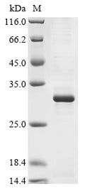 (Tris-Glycine gel) Discontinuous SDS-PAGE (reduced) with 5% enrichment gel and 15% separation gel.
