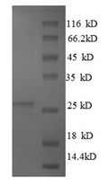 Recombinant Bovine Metalloproteinase inhibitor 4 (TIMP4) – Figure 1 of 1