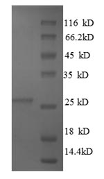 Recombinant Bovine Metalloproteinase inhibitor 4 (TIMP4) – Figure 1 of 1