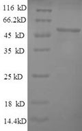 Recombinant Human herpesvirus 1 Thymidine kinase (TK) – Figure 1 of 1