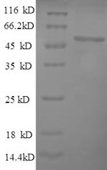 Recombinant Human herpesvirus 1 Thymidine kinase (TK) – Figure 1 of 1