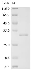 (Tris-Glycine gel) Discontinuous SDS-PAGE (reduced) with 5% enrichment gel and 15% separation gel.