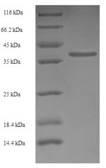 Recombinant Human Transmembrane protein 141 (TMEM141) – Figure 1 of 1