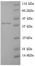 Recombinant Human Transmembrane protein 14B (TMEM14B) – Figure 1 of 1