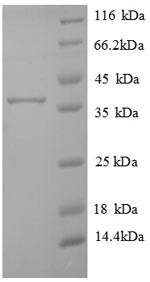 Recombinant Human Transmembrane protein 14B (TMEM14B) – Figure 1 of 1