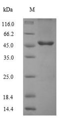 Recombinant Human Transmembrane protein 25 (TMEM25) – Figure 1 of 1