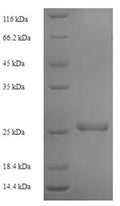 Recombinant Human Transmembrane protein 98 (TMEM98) – Figure 1 of 1