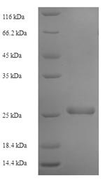 Recombinant Human Transmembrane protein 98 (TMEM98) – Figure 1 of 1