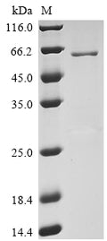 Recombinant Human Transmembrane protease serine 2 (TMPRSS2), partial – Figure 1 of 1