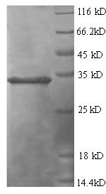 Recombinant Human Tumor necrosis factor-inducible gene 6 protein (TNFAIP6)