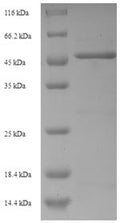 Recombinant Human Tumor necrosis factor receptor superfamily member 21 (TNFRSF21), partial – Figure 1 of 1