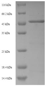 Recombinant Human Tumor necrosis factor receptor superfamily member 21 (TNFRSF21), partial – Figure 1 of 1