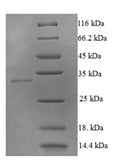 Recombinant Human Tumor necrosis factor ligand superfamily member 10 (TNFSF10), partial – Figure 1 of 1