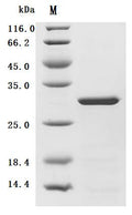 (Tris-Glycine gel) Discontinuous SDS-PAGE (reduced) with 5% enrichment gel and 15% separation gel.