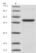 (Tris-Glycine gel) Discontinuous SDS-PAGE (reduced) with 5% enrichment gel and 15% separation gel.