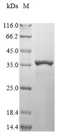 (Tris-Glycine gel) Discontinuous SDS-PAGE (reduced) with 5% enrichment gel and 15% separation gel.