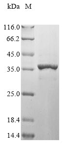 (Tris-Glycine gel) Discontinuous SDS-PAGE (reduced) with 5% enrichment gel and 15% separation gel.