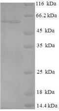 Recombinant Human Cellular tumor antigen p53 (TP53) – Figure 1 of 1