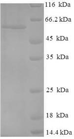 Recombinant Human Cellular tumor antigen p53 (TP53) – Figure 1 of 1