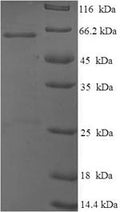 Recombinant Mouse Cellular tumor antigen p53 (Tp53), partial – Figure 1 of 1