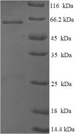 Recombinant Mouse Cellular tumor antigen p53 (Tp53), partial – Figure 1 of 1