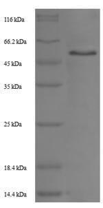 Recombinant Rat Trophoblast glycoprotein (Tpbg), partial – Figure 1 of 1