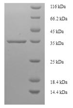Recombinant Human Tumor protein D52 (TPD52) – Figure 1 of 1