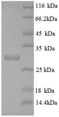 Recombinant Mouse Tryptase (Tpsab1), partial – Figure 1 of 1