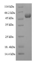 Recombinant Human Protein-tyrosine sulfotransferase 2 (TPST2), partial – Figure 1 of 1