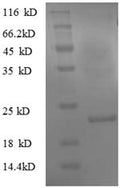 Recombinant Mouse Translationally-controlled tumor protein (Tpt1) – Figure 1 of 1