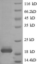 Recombinant Human T cell receptor alpha chain constant (TRAC) – Figure 1 of 1