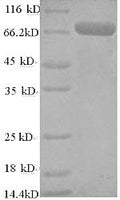Recombinant Human TNF receptor-associated factor 6 (TRAF6) – Figure 1 of 1