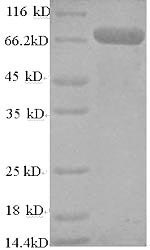 Recombinant Human TNF receptor-associated factor 6 (TRAF6) – Figure 1 of 1