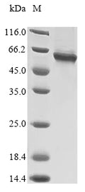 (Tris-Glycine gel) Discontinuous SDS-PAGE (reduced) with 5% enrichment gel and 15% separation gel.